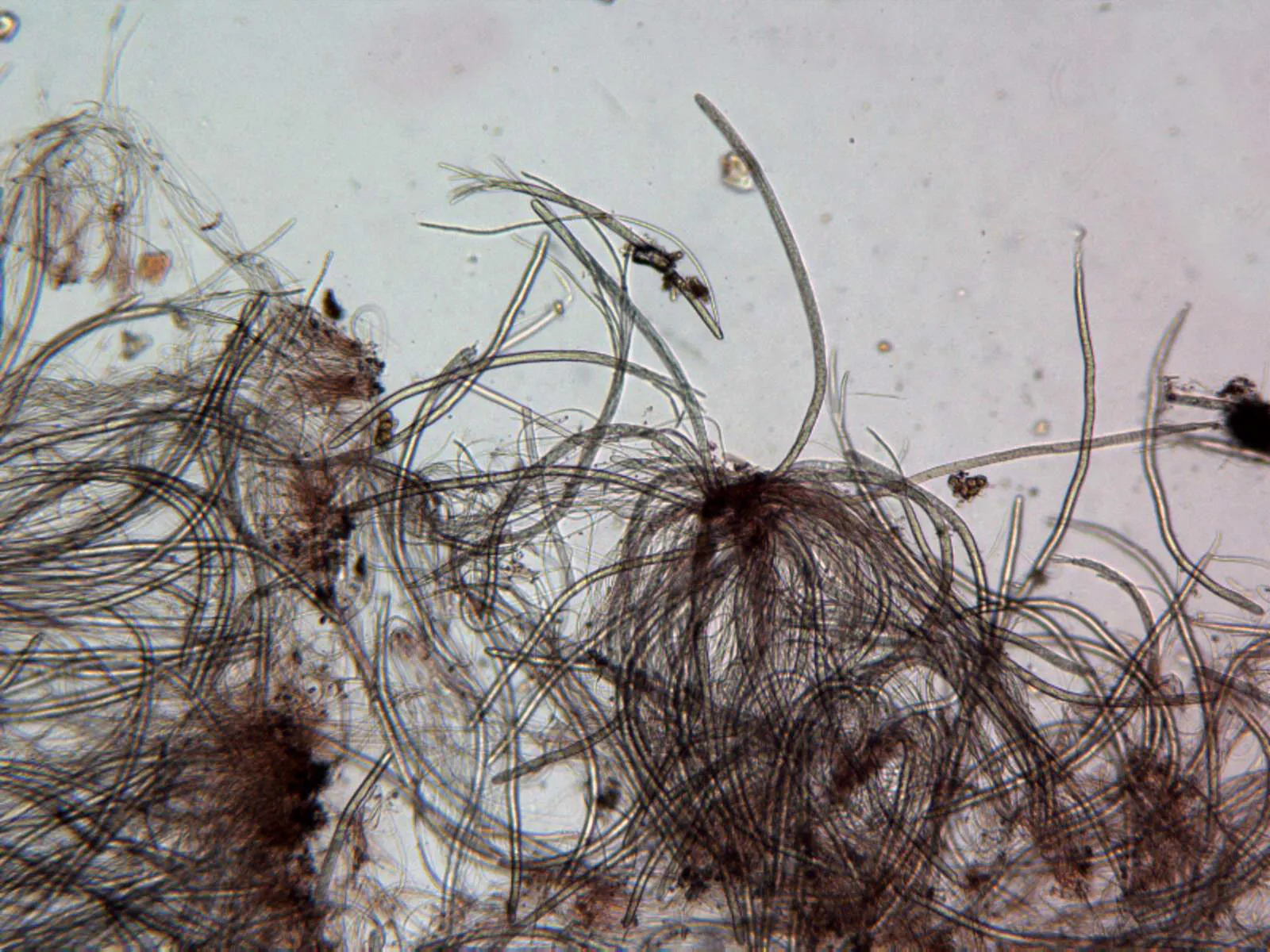 Microscopía de Schizoxylon alboatrum - 10 x 100